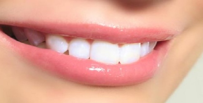 علاج تسوس الاسنان